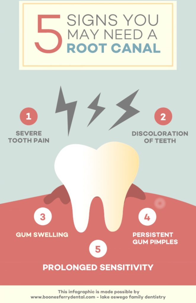 5 Signs That Might Signal A Root Canal