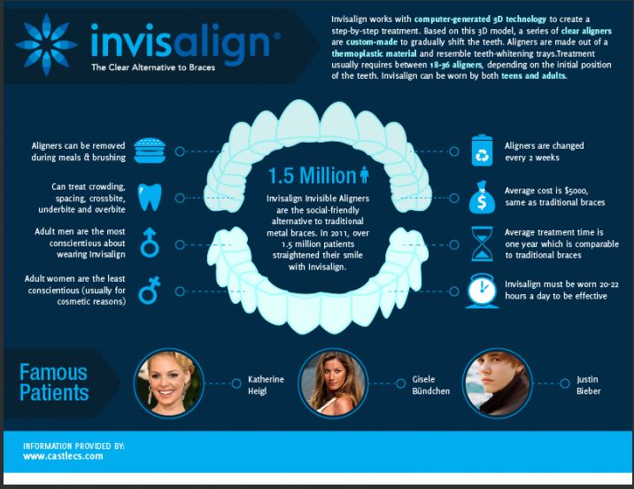 The Tooth About Invisalign Braces